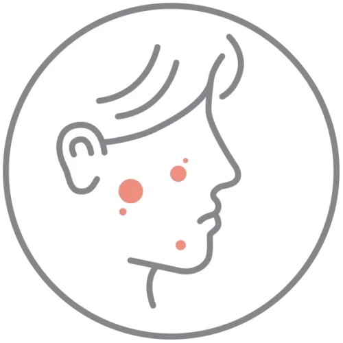 grain-de-peau-irregulier