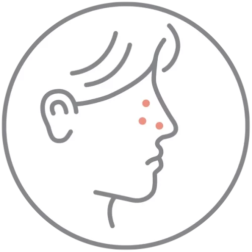pores-dilates